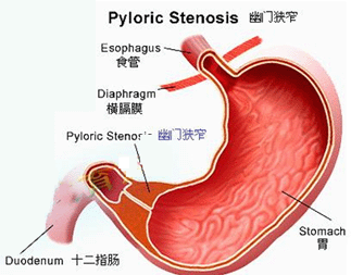慢性萎缩性胃炎治疗新思路