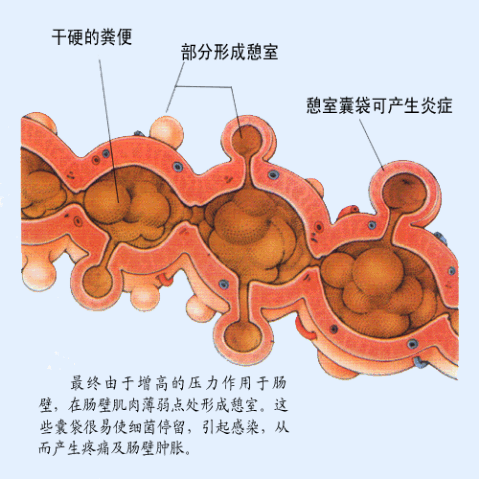 宿便怎么样